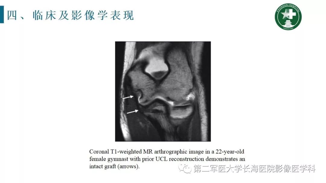 【PPT】肘关节运动损伤MR诊断