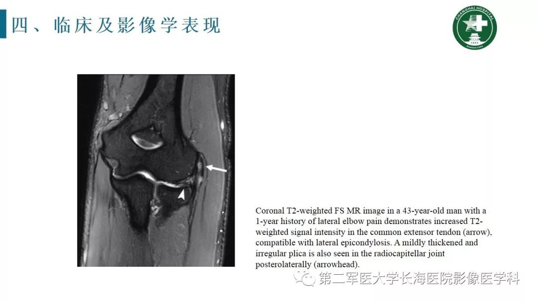 【PPT】肘关节运动损伤MR诊断