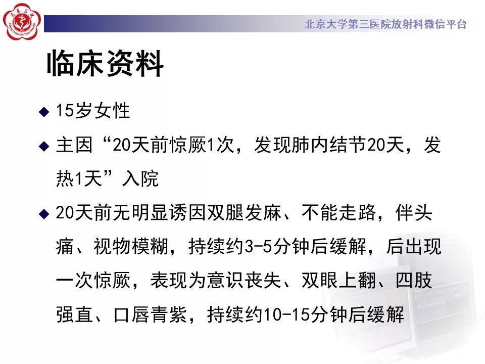 【PPT】遗传性出血性毛细血管扩张症