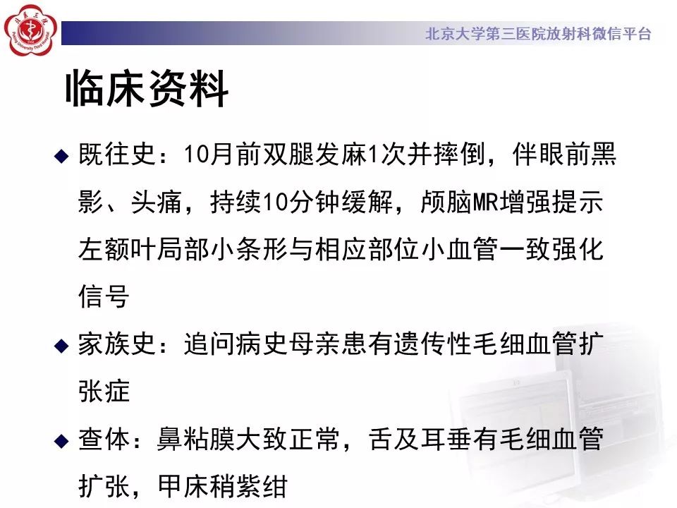 【PPT】遗传性出血性毛细血管扩张症