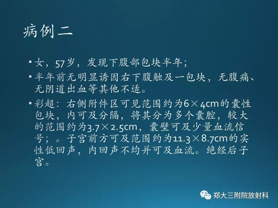 【PPT】卵泡膜纤维瘤的诊断及鉴别诊断