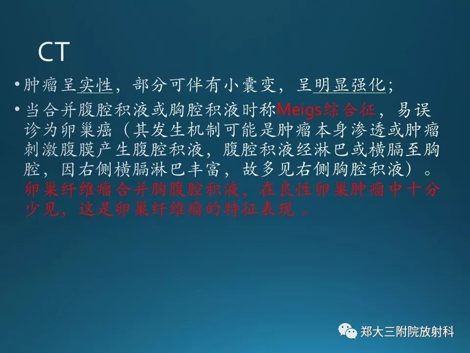 【PPT】卵泡膜纤维瘤的诊断及鉴别诊断