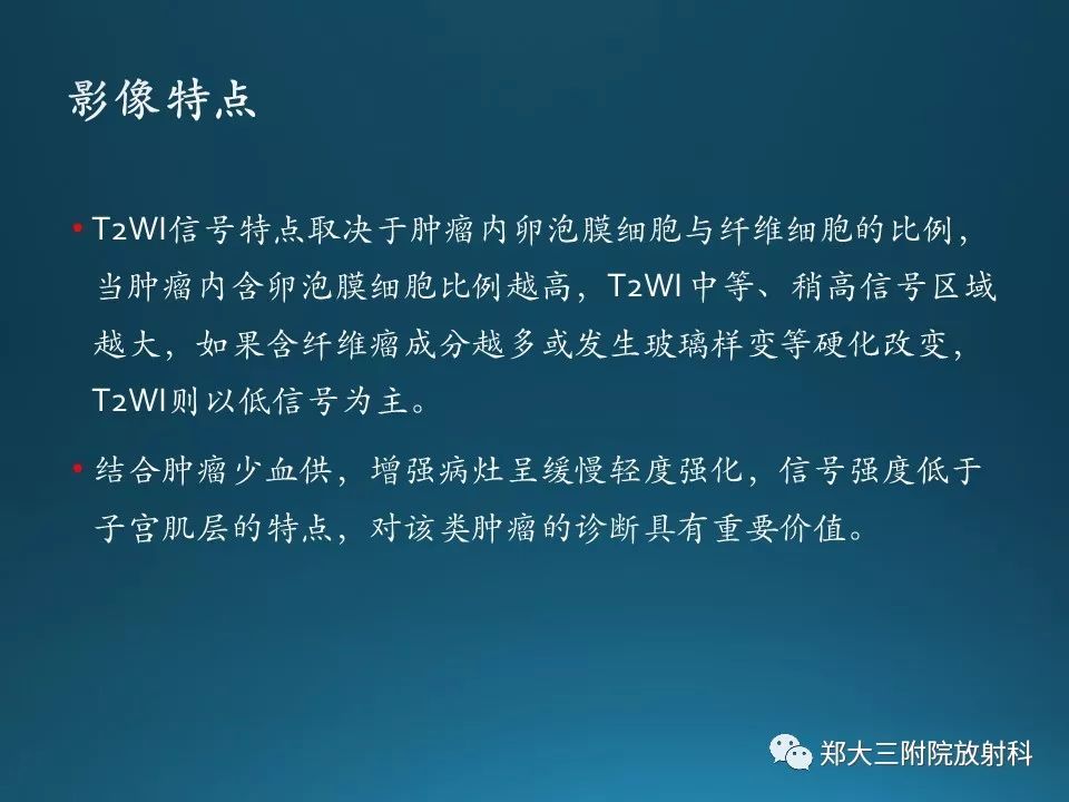 【PPT】卵泡膜纤维瘤的诊断及鉴别诊断