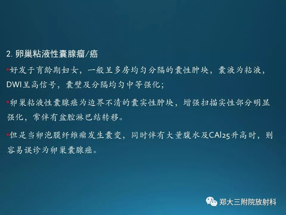 【PPT】卵泡膜纤维瘤的诊断及鉴别诊断