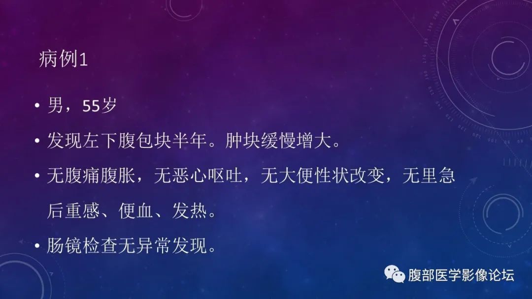 【病例】盆腔精原细胞瘤1例CT影像讨论 【病例】盆腔精原细胞瘤1例CT影像讨论