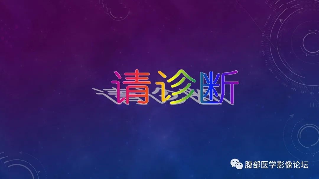 【病例】盆腔精原细胞瘤1例CT影像讨论 【病例】盆腔精原细胞瘤1例CT影像讨论