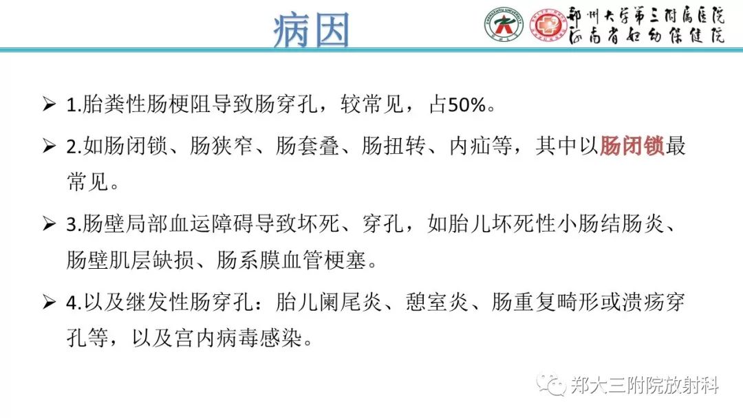 【PPT】胎粪性腹膜炎的影像诊断
