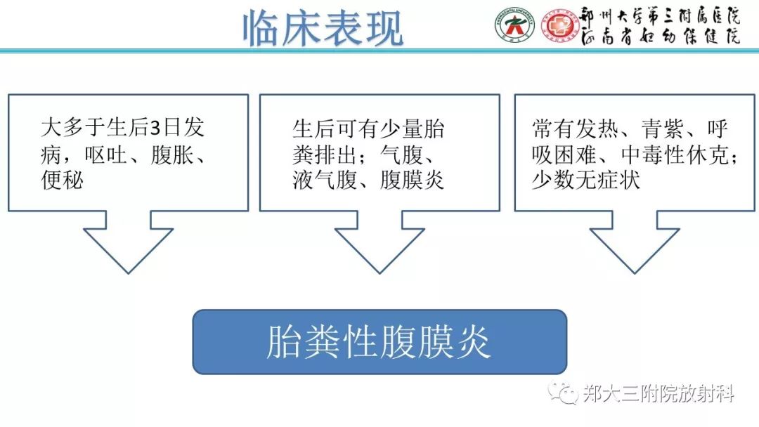 【PPT】胎粪性腹膜炎的影像诊断