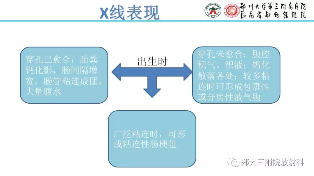 【PPT】胎粪性腹膜炎的影像诊断