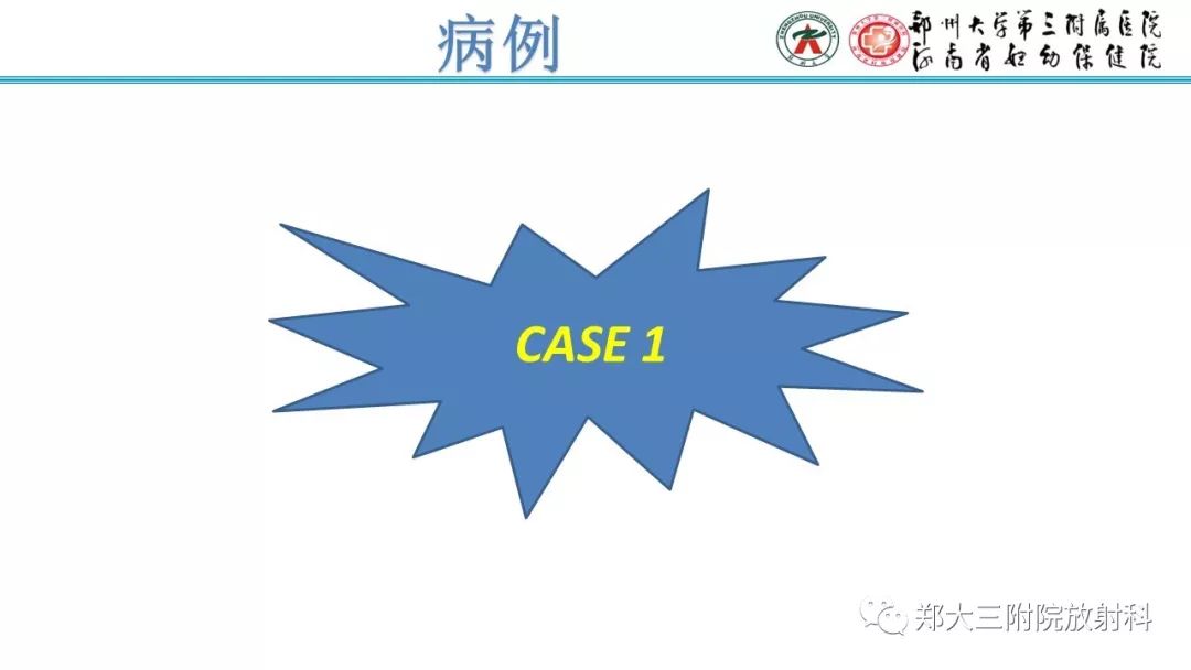 【PPT】胎粪性腹膜炎的影像诊断