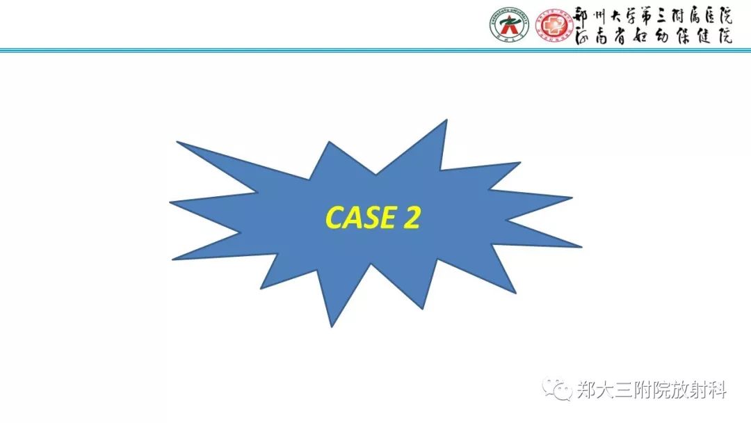 【PPT】胎粪性腹膜炎的影像诊断