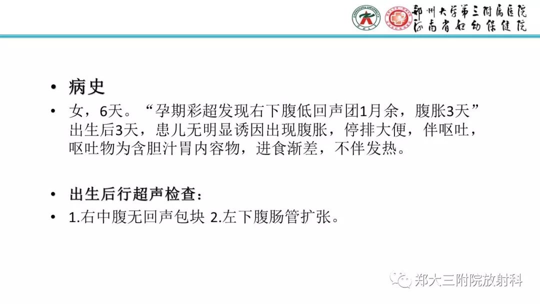 【PPT】胎粪性腹膜炎的影像诊断