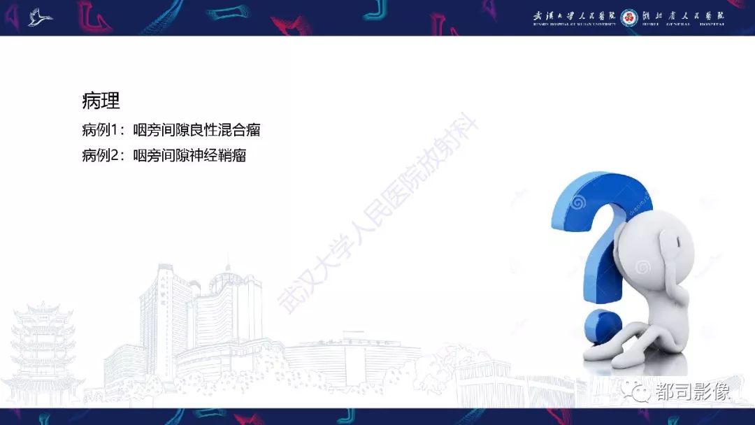 【PPT】咽旁间隙解剖及病变影像诊断