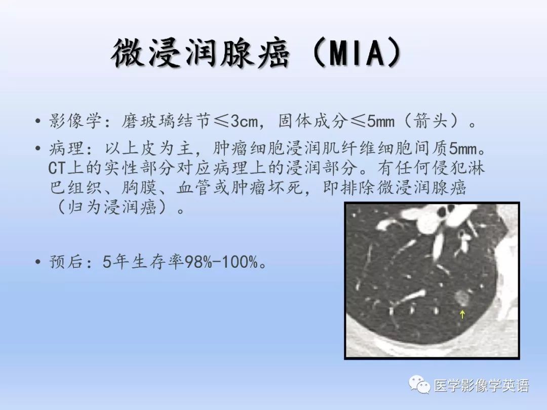 【PPT】第八版肺腺癌TNM分期影像学解读 【PPT】第八版肺腺癌TNM分期影像学解读