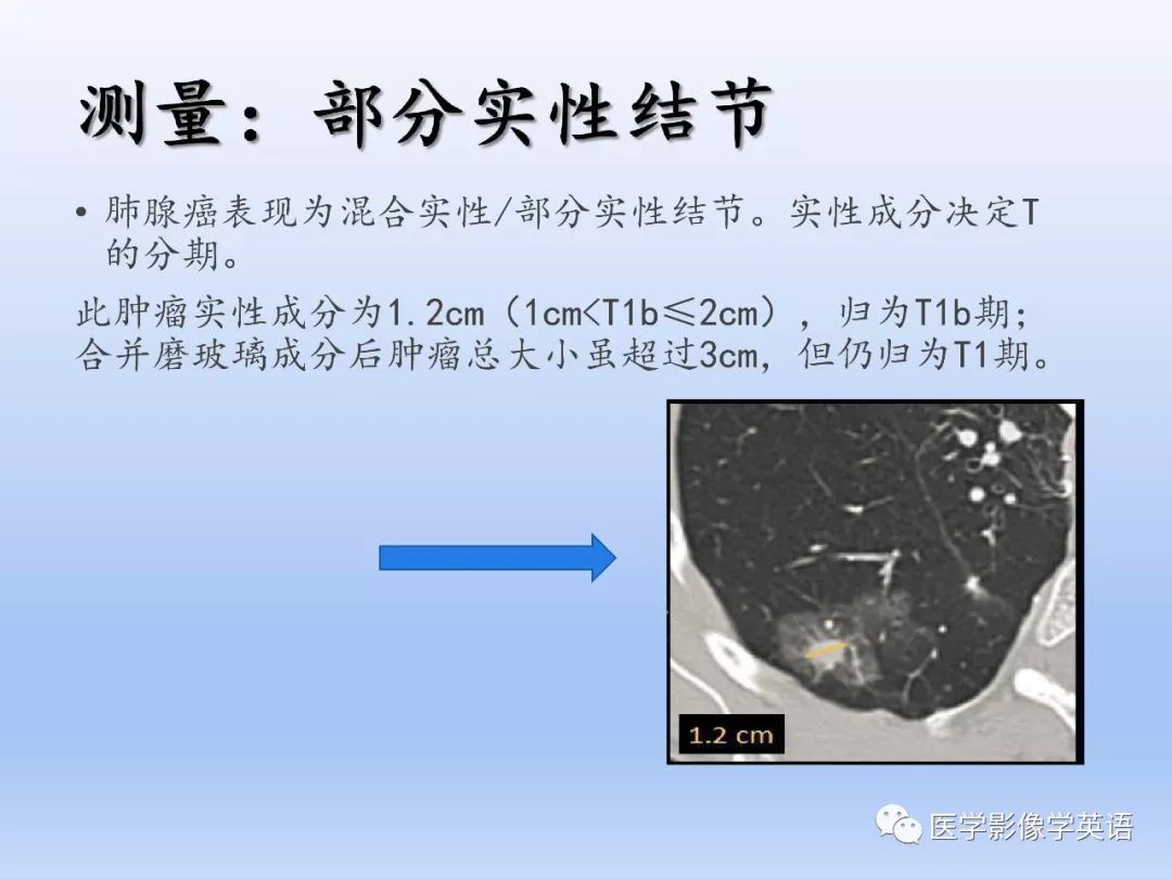 【PPT】第八版肺腺癌TNM分期影像学解读 【PPT】第八版肺腺癌TNM分期影像学解读