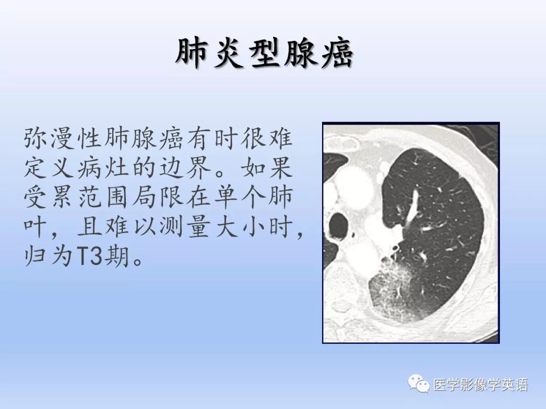 【PPT】第八版肺腺癌TNM分期影像学解读 【PPT】第八版肺腺癌TNM分期影像学解读
