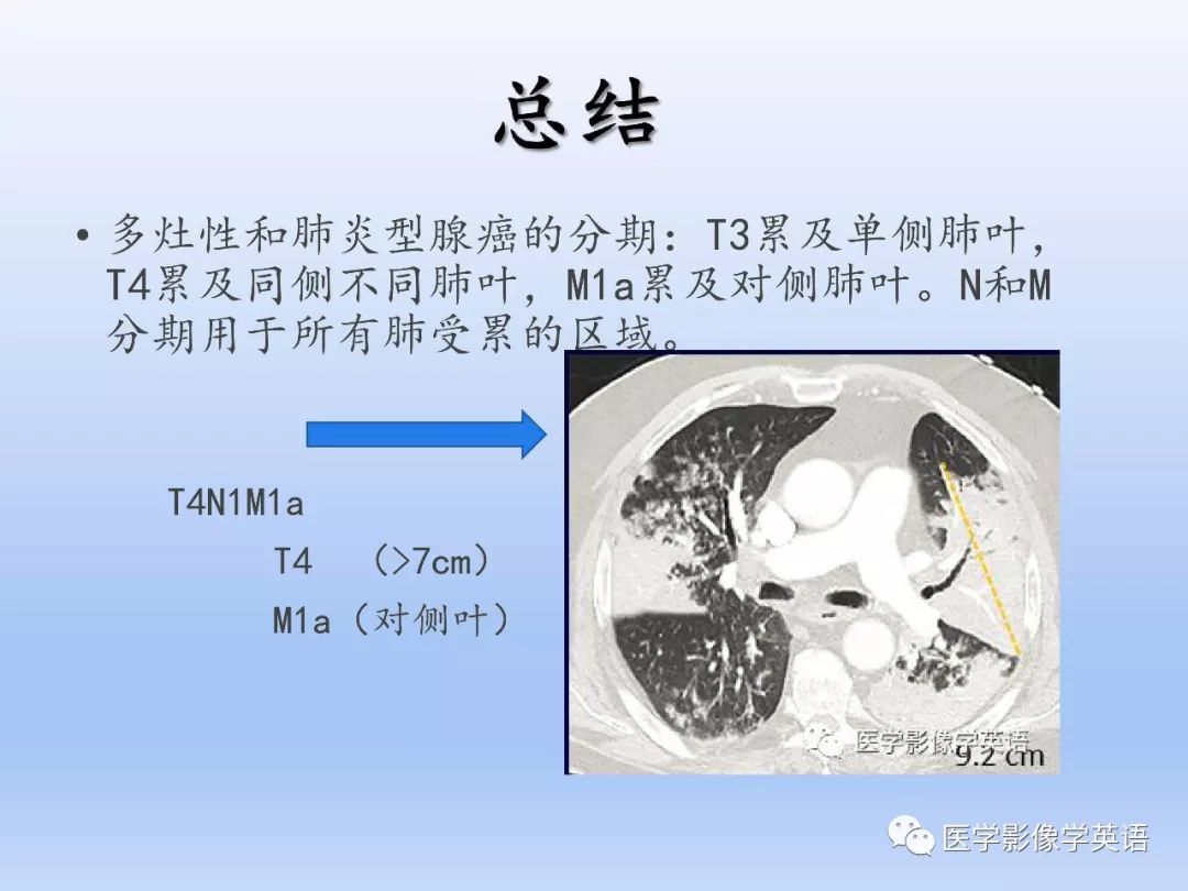 【PPT】第八版肺腺癌TNM分期影像学解读 【PPT】第八版肺腺癌TNM分期影像学解读