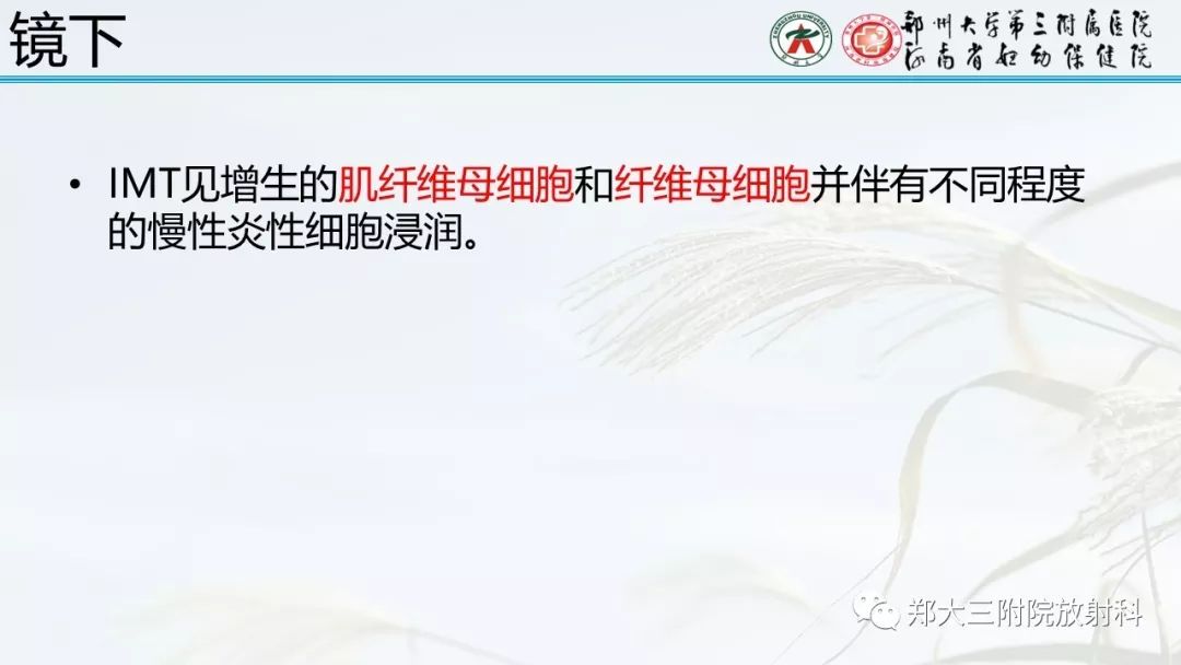 【PPT】炎性肌纤维母细胞瘤的影像表现