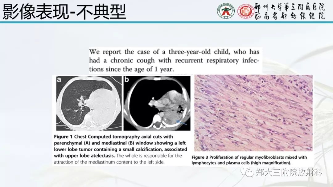 【PPT】炎性肌纤维母细胞瘤的影像表现