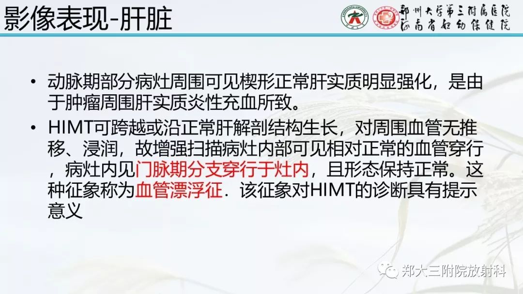 【PPT】炎性肌纤维母细胞瘤的影像表现