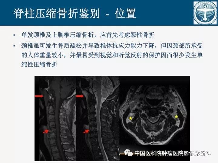 【PPT】椎体压缩骨折MRI鉴别诊断