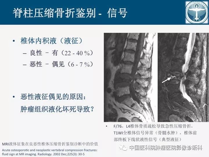 【PPT】椎体压缩骨折MRI鉴别诊断