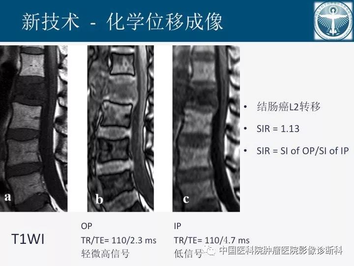 【PPT】椎体压缩骨折MRI鉴别诊断