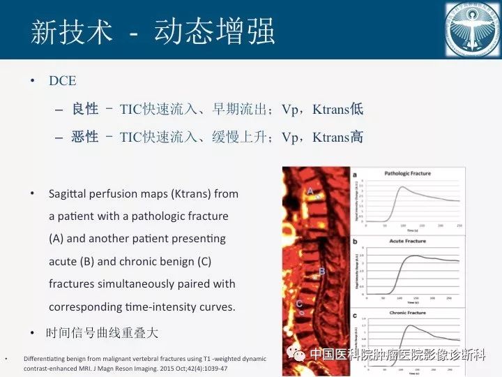 【PPT】椎体压缩骨折MRI鉴别诊断