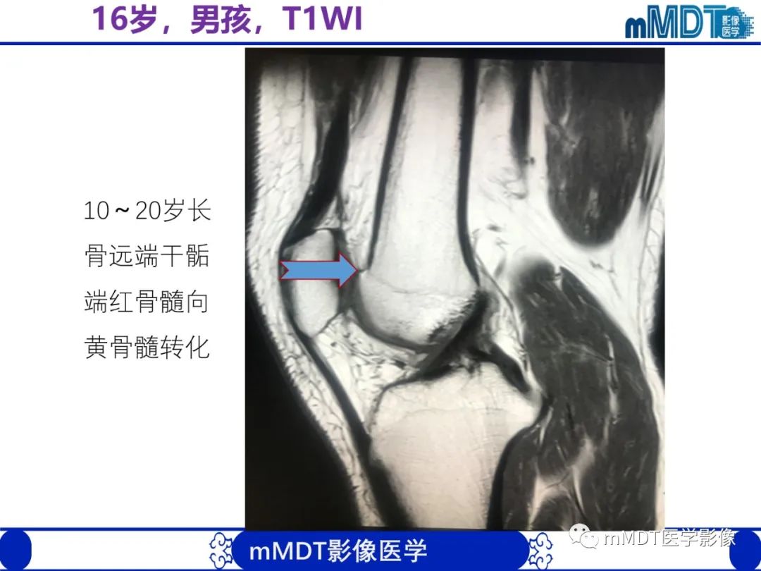 【PPT】骨髓的转化与逆转化