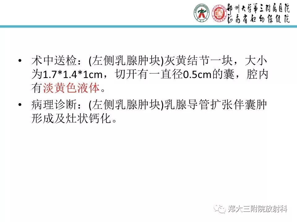 【PPT】乳腺囊肿的X线表现