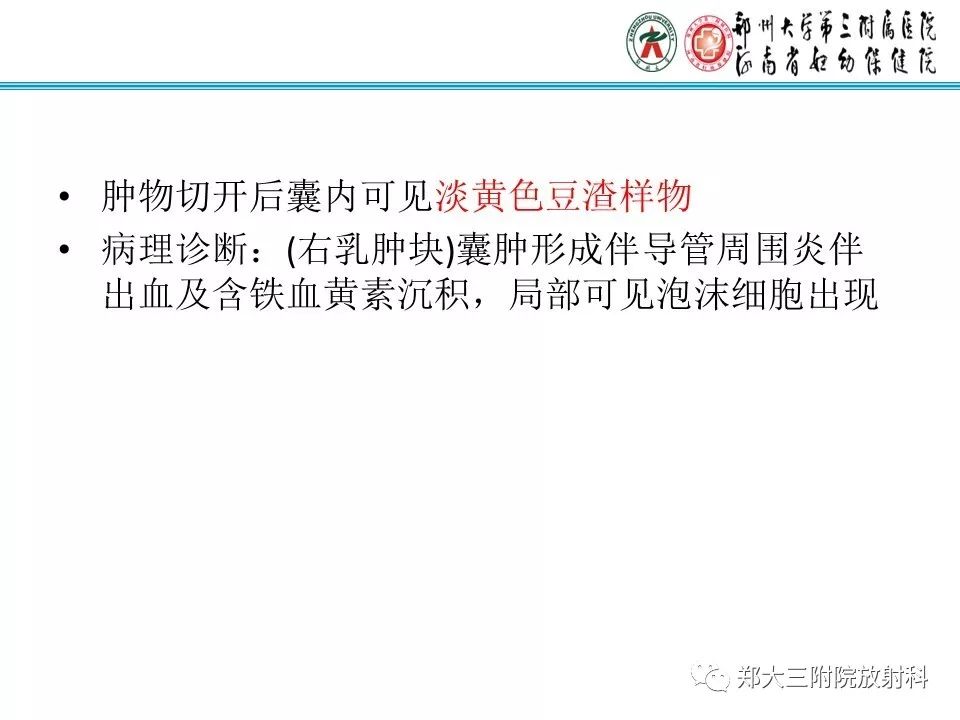 【PPT】乳腺囊肿的X线表现