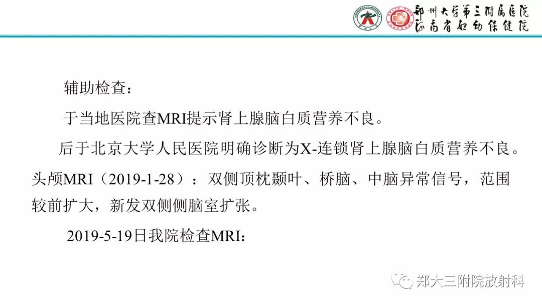 【PPT】肾上腺脑白质营养不良的影像诊断