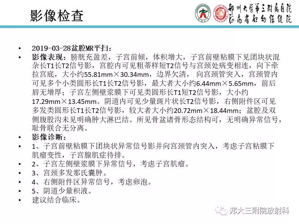 【病例】子宫腺肌瘤性息肉1例MR影像
