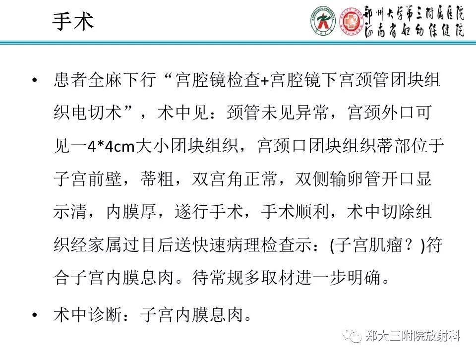 【病例】子宫腺肌瘤性息肉1例MR影像