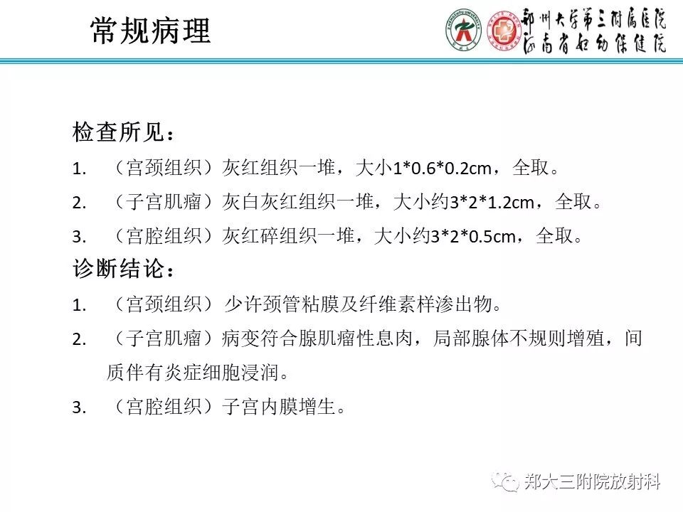 【病例】子宫腺肌瘤性息肉1例MR影像