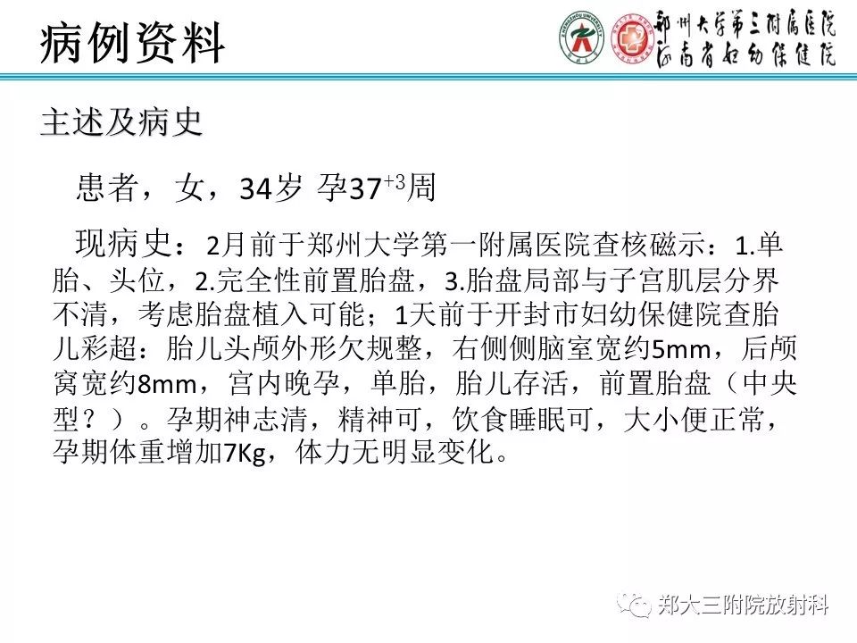 【PPT】颅缝早闭