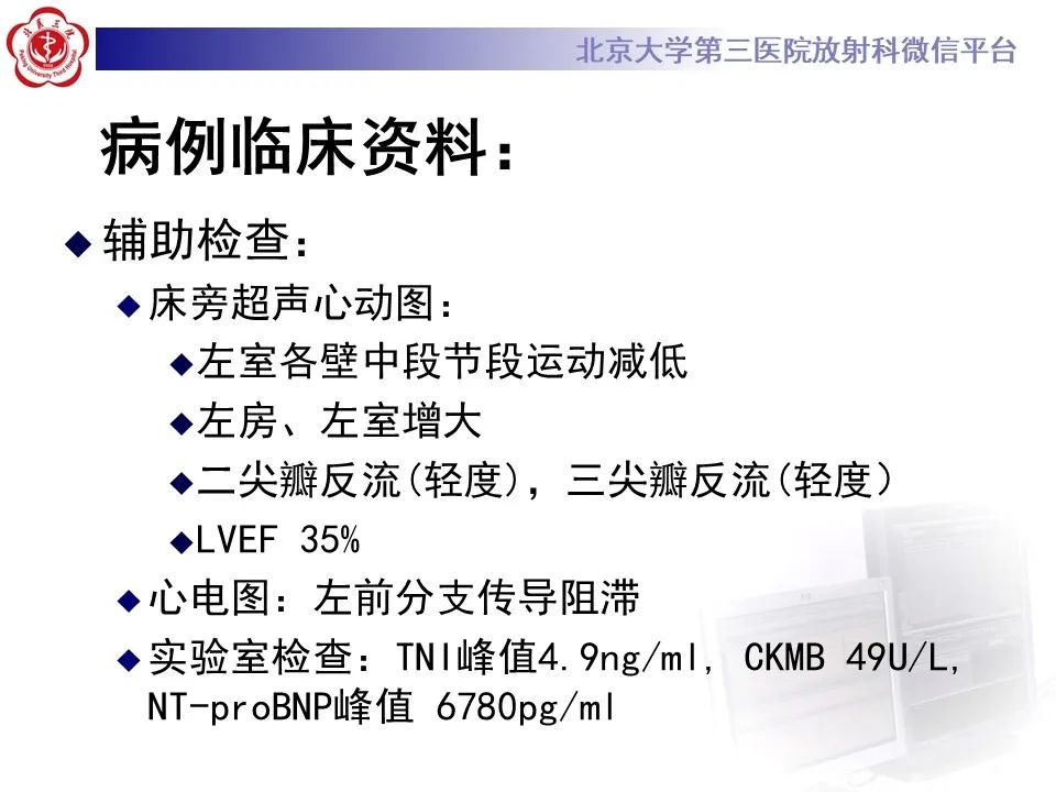 【病例】应激性心肌病1例MR影像
