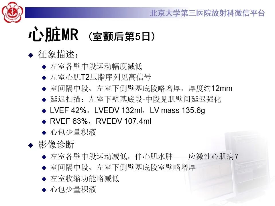 【病例】应激性心肌病1例MR影像