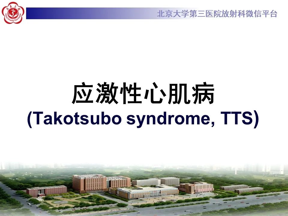 【病例】应激性心肌病1例MR影像
