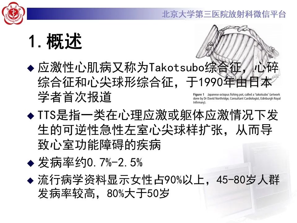 【病例】应激性心肌病1例MR影像
