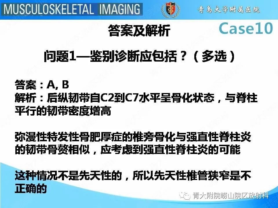 【PPT】后纵韧带骨化症