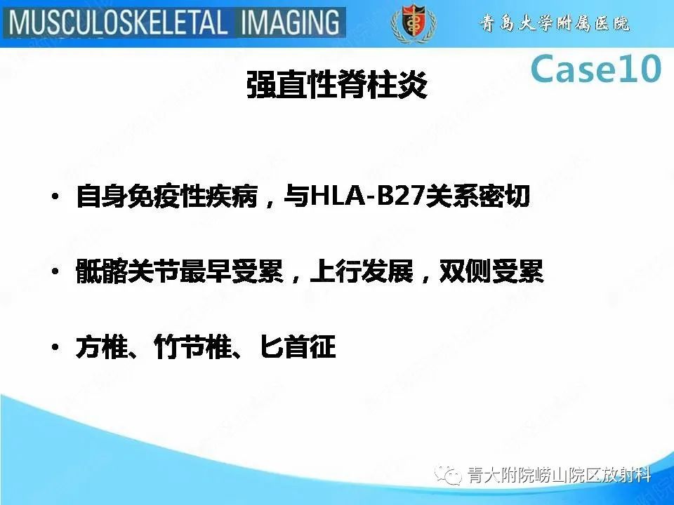 【PPT】后纵韧带骨化症