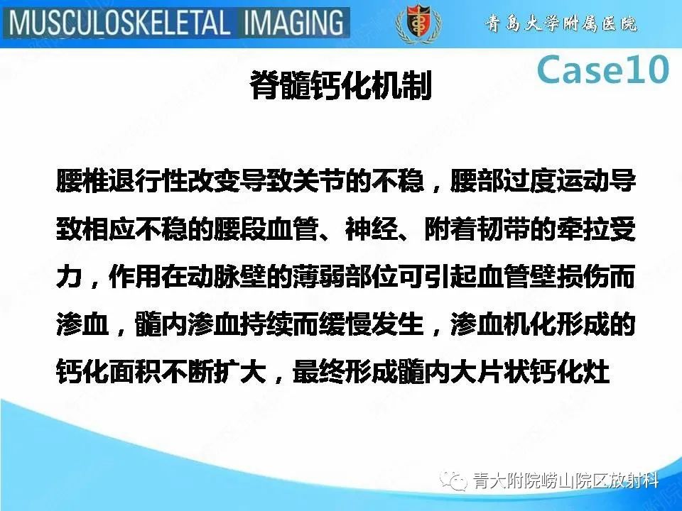 【PPT】后纵韧带骨化症