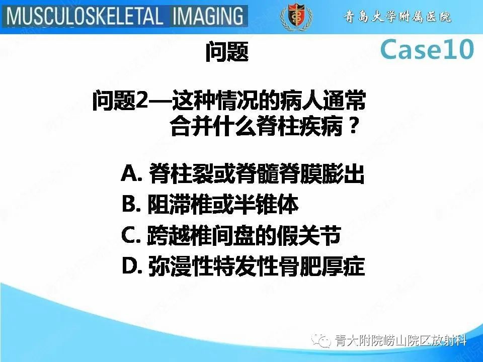【PPT】后纵韧带骨化症