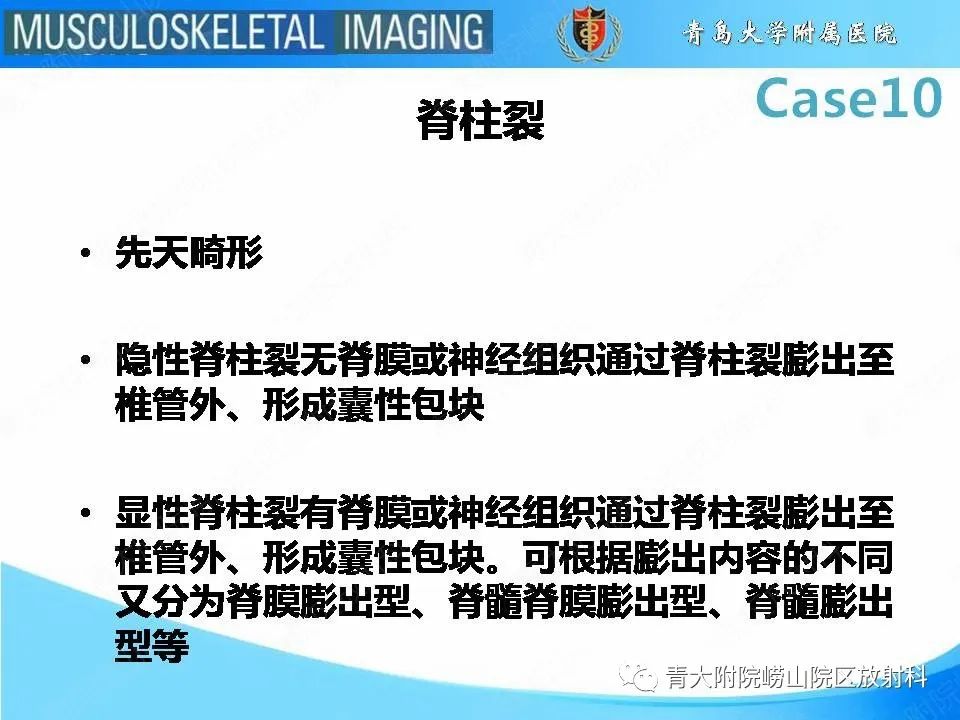 【PPT】后纵韧带骨化症