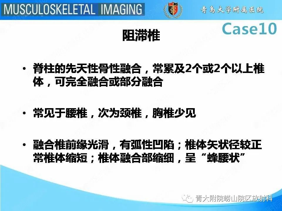 【PPT】后纵韧带骨化症