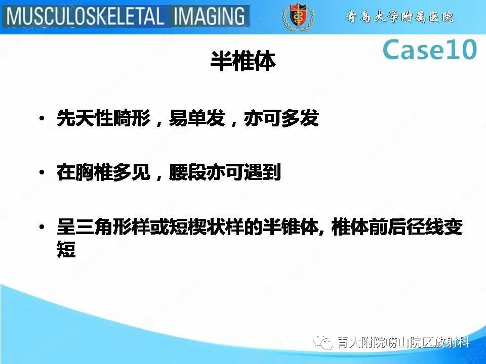 【PPT】后纵韧带骨化症