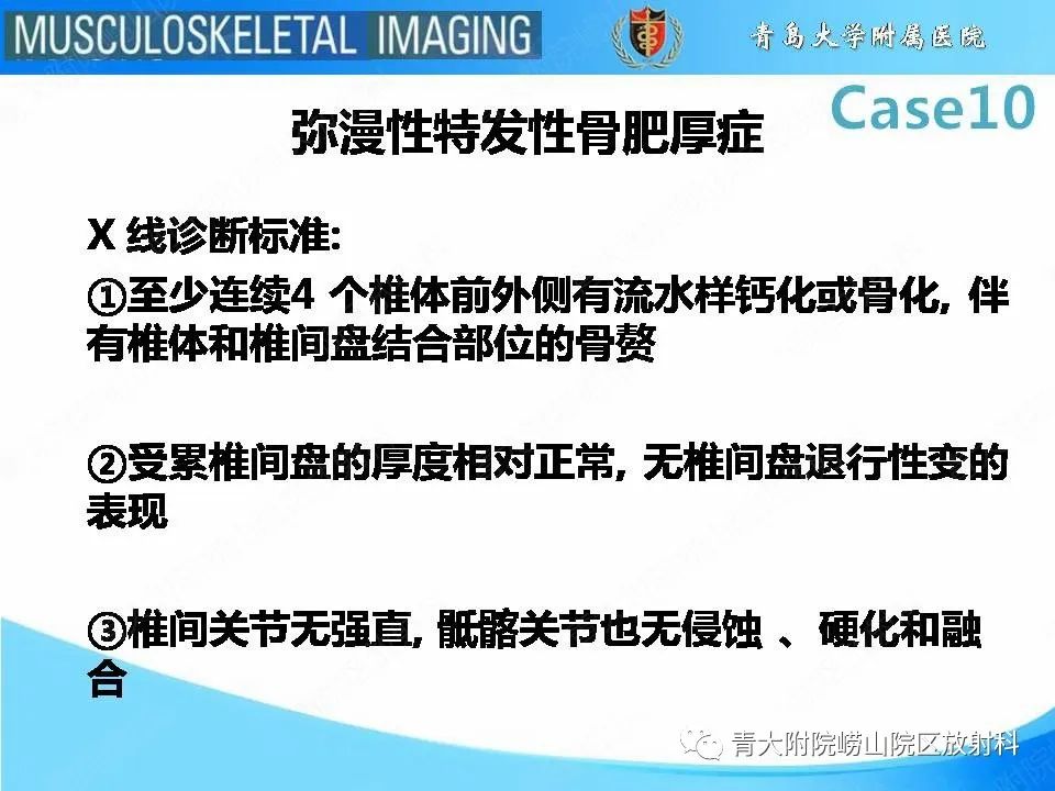 【PPT】后纵韧带骨化症