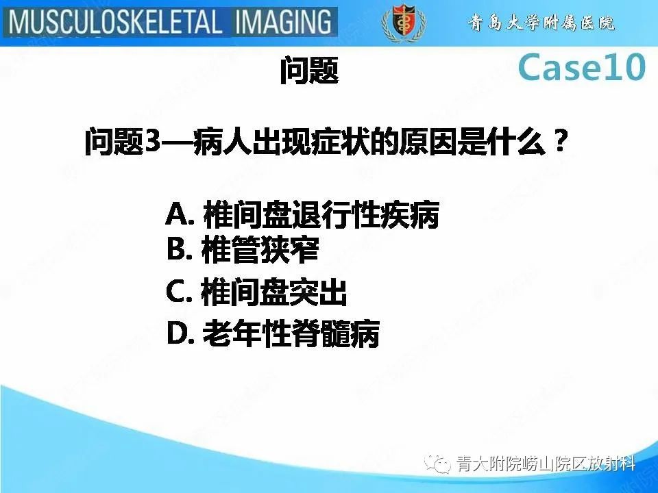 【PPT】后纵韧带骨化症
