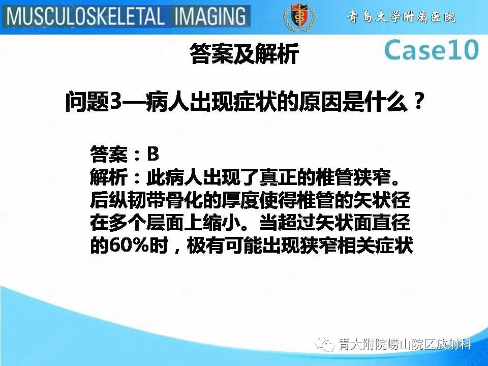 【PPT】后纵韧带骨化症